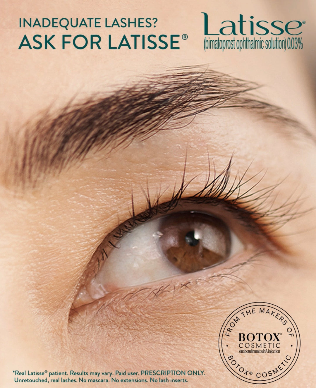 Latisse 0.03% 5 mL (140 Disposable Applicators)