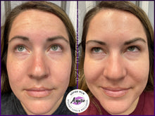 Load image into Gallery viewer, VIP Botox Membership
