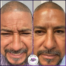 Load image into Gallery viewer, VIP Botox Membership
